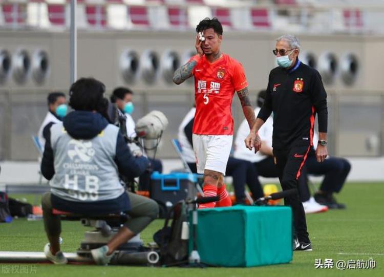 内马尔脚受伤「医学解析内马尔脚踝严重变形赛季报销广州队曾有多人韧带重伤」